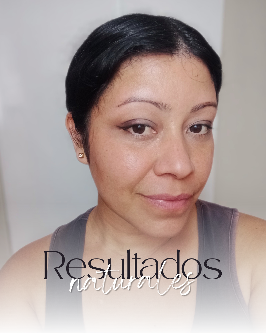Resultados Naturales